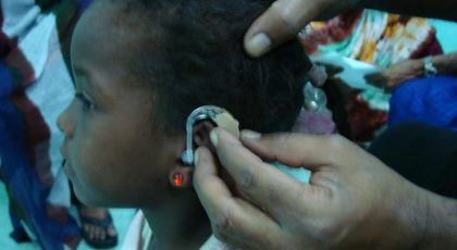 دراسة جديدة تكشف سبب إصابة الموريتانيين بالصمم